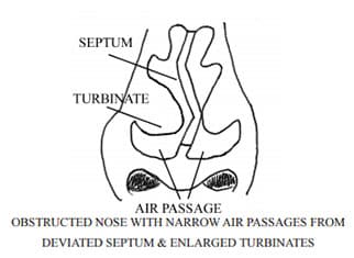 Illustration of healthy nasal structure for ENT reference, Dearborn, MI, and Livonia, MI